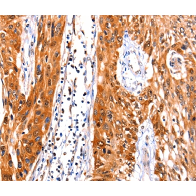Immunohistochemistry - FBLN1 Antibody from Signalway Antibody (36852) - Antibodies.com