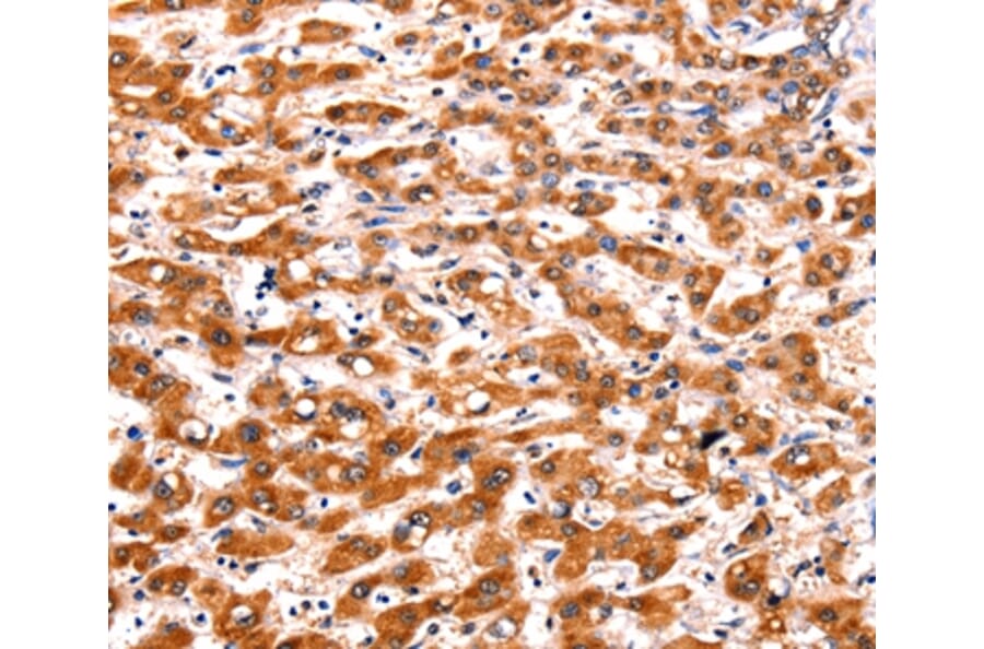 Immunohistochemistry - FBLN1 Antibody from Signalway Antibody (36852) - Antibodies.com