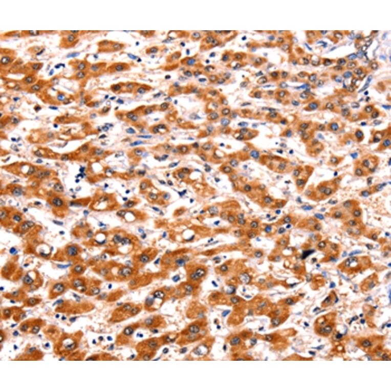 Immunohistochemistry - FBLN1 Antibody from Signalway Antibody (36852) - Antibodies.com