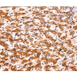 Immunohistochemistry - FBLN1 Antibody from Signalway Antibody (36852) - Antibodies.com