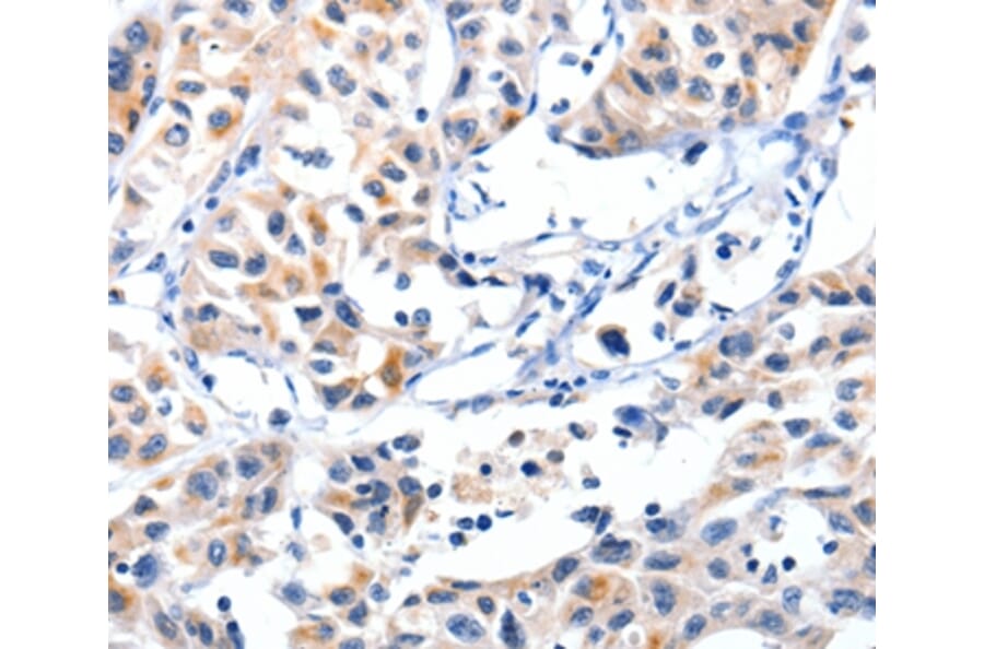Immunohistochemistry - FBLN5 Antibody from Signalway Antibody (36853) - Antibodies.com