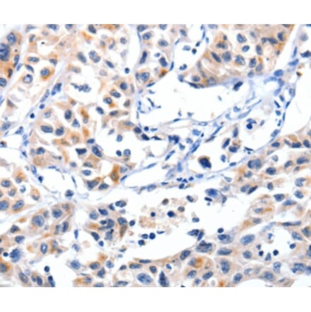Immunohistochemistry - FBLN5 Antibody from Signalway Antibody (36853) - Antibodies.com