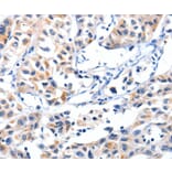 Immunohistochemistry - FBLN5 Antibody from Signalway Antibody (36853) - Antibodies.com