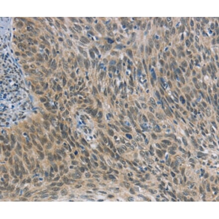 Immunohistochemistry - FOXF1 Antibody from Signalway Antibody (36858) - Antibodies.com