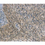 Immunohistochemistry - FOXF1 Antibody from Signalway Antibody (36858) - Antibodies.com