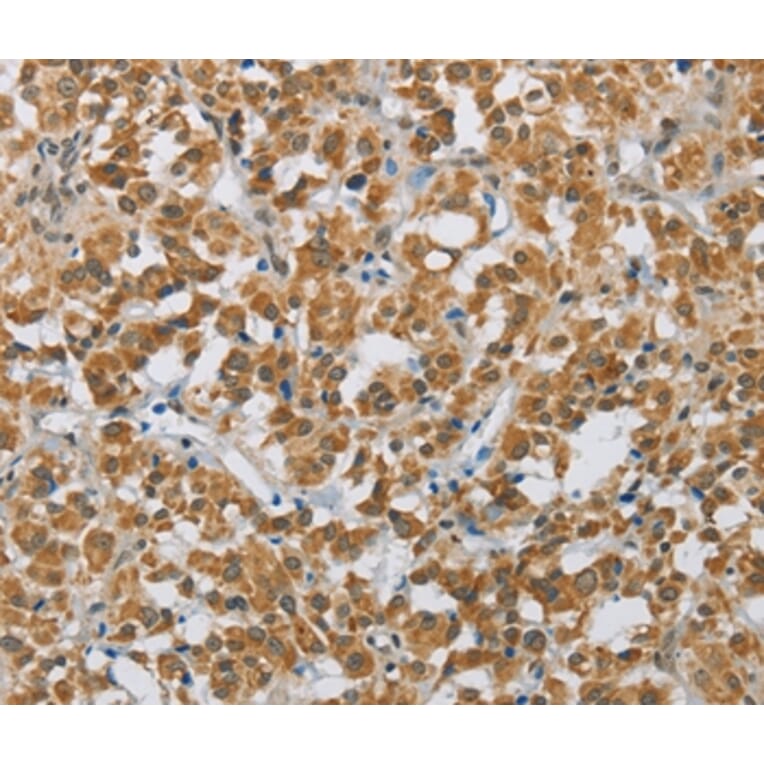 Immunohistochemistry - FOXF1 Antibody from Signalway Antibody (36858) - Antibodies.com