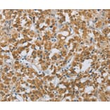 Immunohistochemistry - FOXF1 Antibody from Signalway Antibody (36858) - Antibodies.com