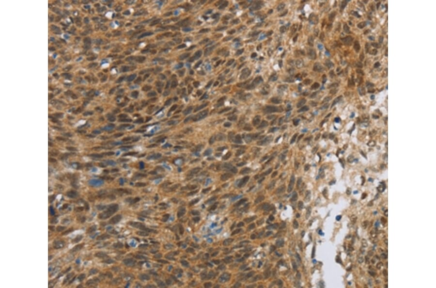 Immunohistochemistry - FOXB1 Antibody from Signalway Antibody (36861) - Antibodies.com