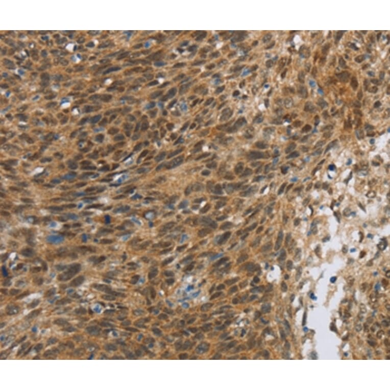 Immunohistochemistry - FOXB1 Antibody from Signalway Antibody (36861) - Antibodies.com