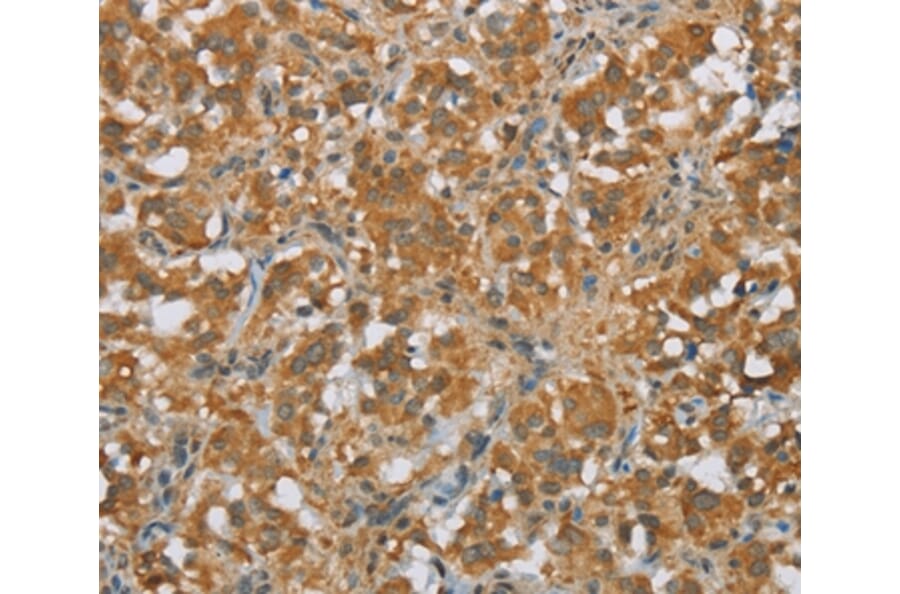 Immunohistochemistry - FOXB1 Antibody from Signalway Antibody (36861) - Antibodies.com