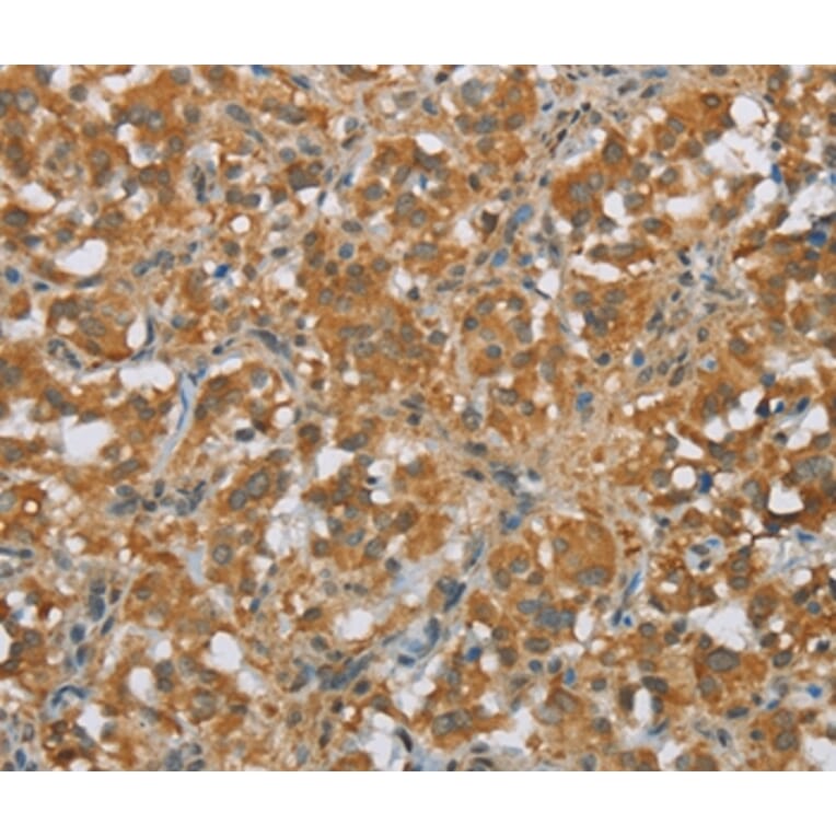 Immunohistochemistry - FOXB1 Antibody from Signalway Antibody (36861) - Antibodies.com