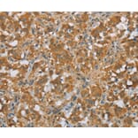 Immunohistochemistry - FOXB1 Antibody from Signalway Antibody (36861) - Antibodies.com