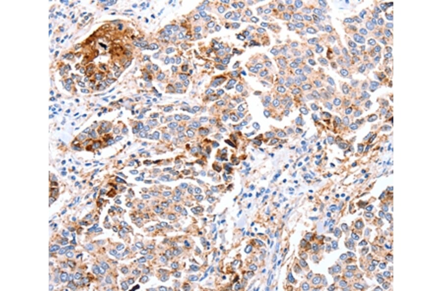Immunohistochemistry - FOXD2 Antibody from Signalway Antibody (36864) - Antibodies.com
