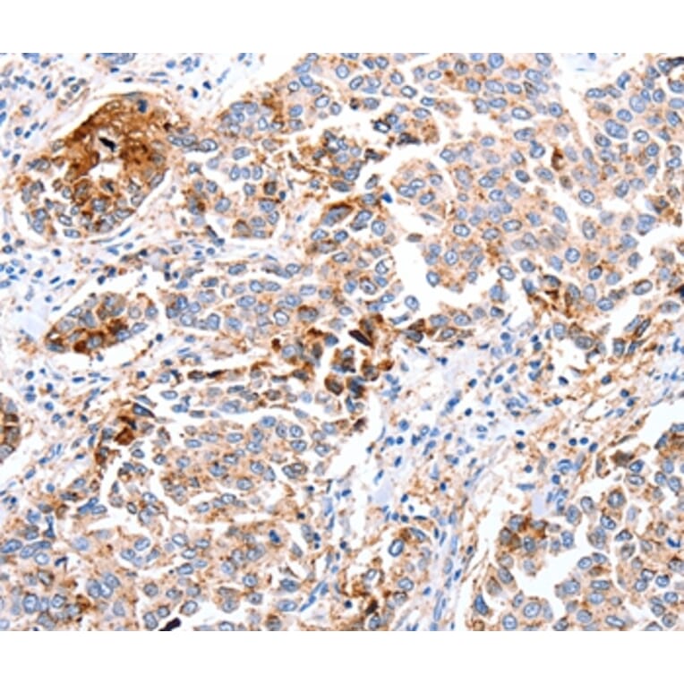 Immunohistochemistry - FOXD2 Antibody from Signalway Antibody (36864) - Antibodies.com