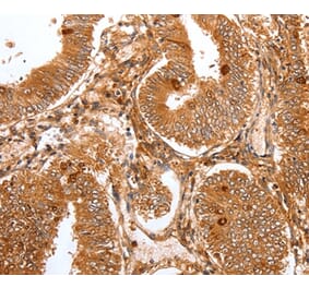 Immunohistochemistry - FOXO3 Antibody from Signalway Antibody (36871) - Antibodies.com
