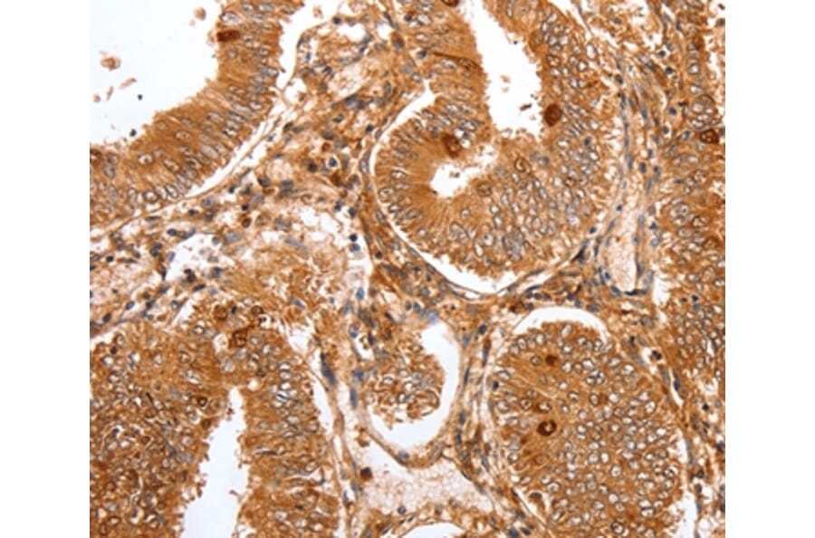 Immunohistochemistry - FOXO3 Antibody from Signalway Antibody (36871) - Antibodies.com