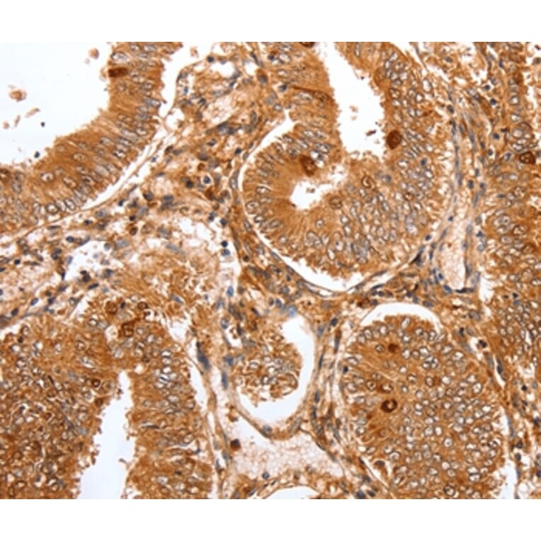 Immunohistochemistry - FOXO3 Antibody from Signalway Antibody (36871) - Antibodies.com