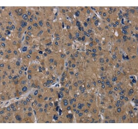 Immunohistochemistry - TRPM1 Antibody from Signalway Antibody (36874) - Antibodies.com