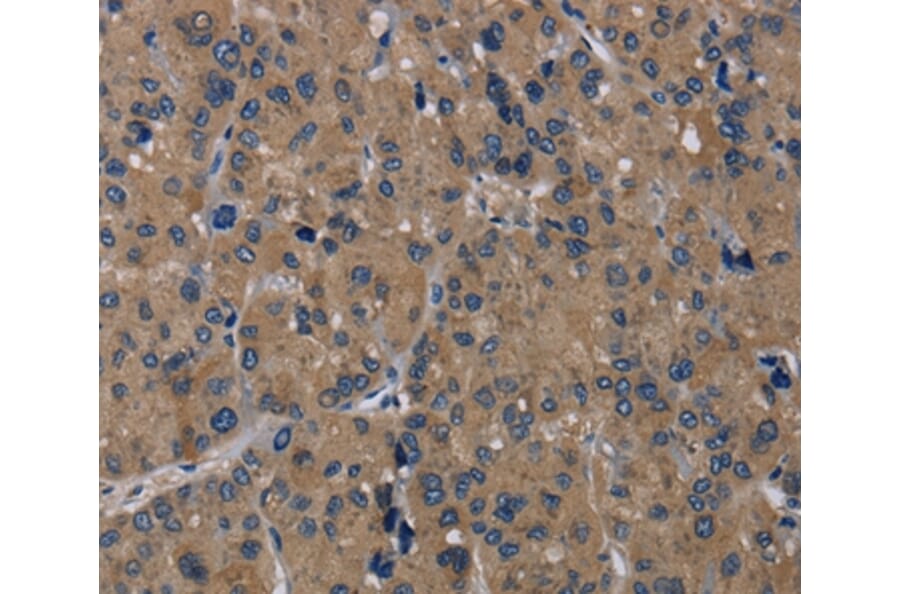 Immunohistochemistry - TRPM1 Antibody from Signalway Antibody (36874) - Antibodies.com