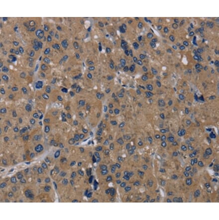 Immunohistochemistry - TRPM1 Antibody from Signalway Antibody (36874) - Antibodies.com