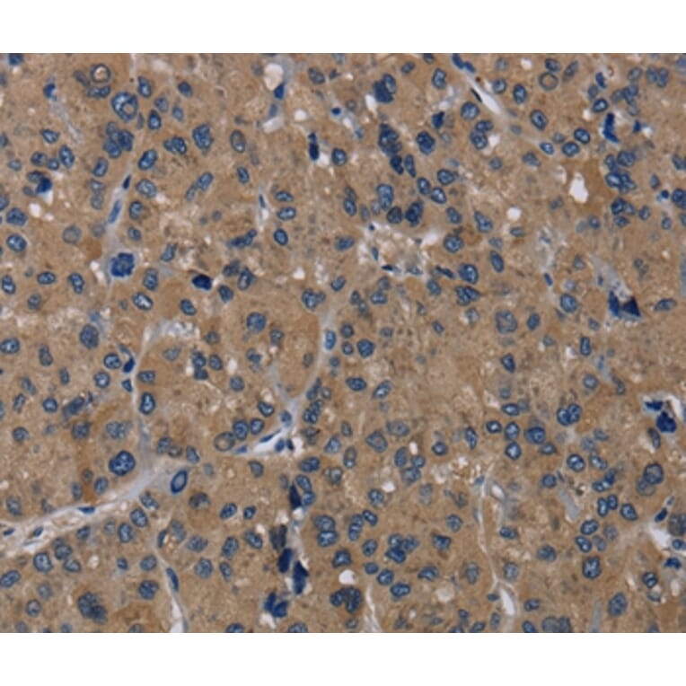 Immunohistochemistry - TRPM1 Antibody from Signalway Antibody (36874) - Antibodies.com