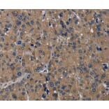 Immunohistochemistry - TRPM1 Antibody from Signalway Antibody (36874) - Antibodies.com