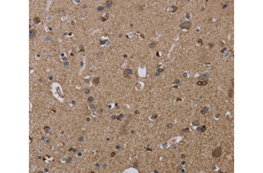 Immunohistochemistry - TRPM1 Antibody from Signalway Antibody (36874) - Antibodies.com