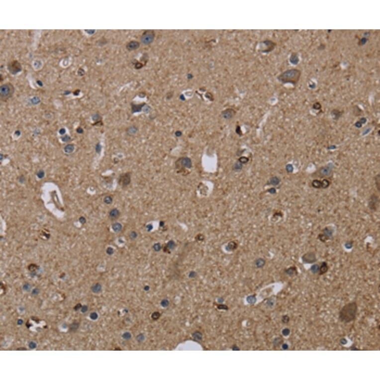Immunohistochemistry - TRPM1 Antibody from Signalway Antibody (36874) - Antibodies.com