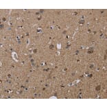 Immunohistochemistry - TRPM1 Antibody from Signalway Antibody (36874) - Antibodies.com