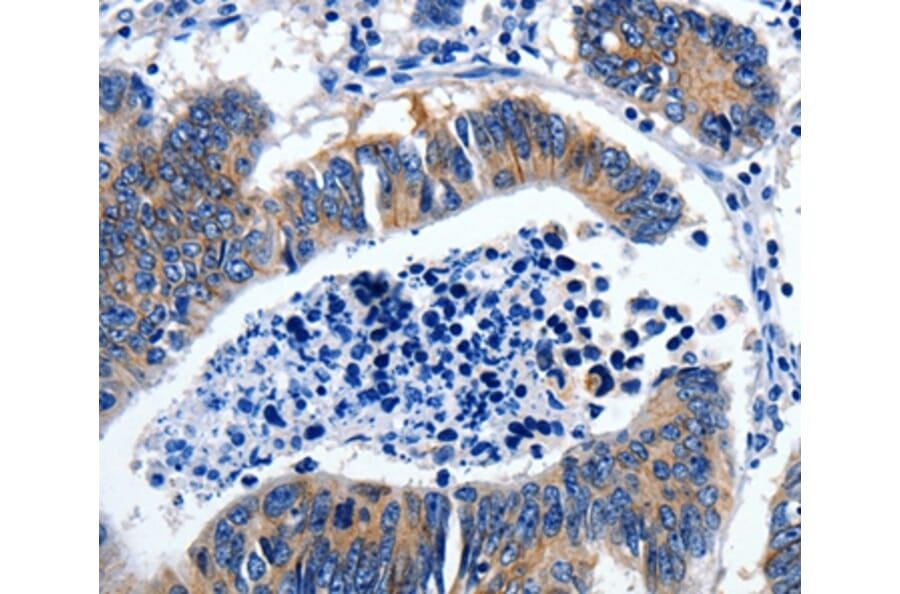 Immunohistochemistry - GAD2 Antibody from Signalway Antibody (36879) - Antibodies.com