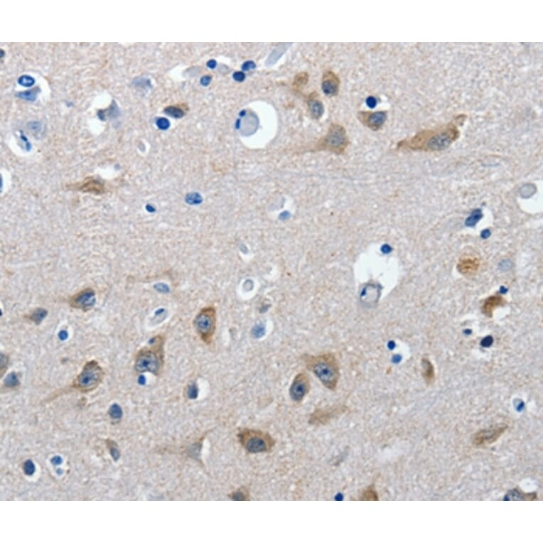 Immunohistochemistry - GAD2 Antibody from Signalway Antibody (36879) - Antibodies.com