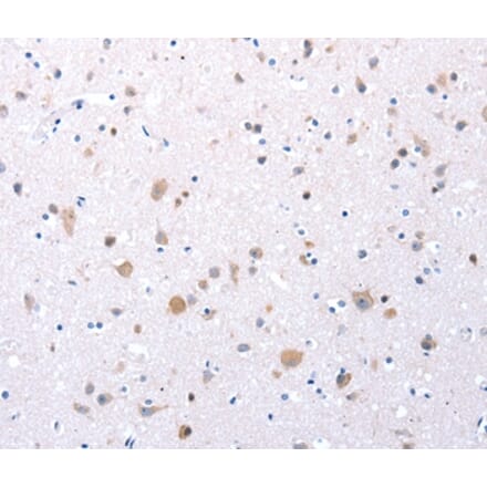 Immunohistochemistry - CCKAR Antibody from Signalway Antibody (36882) - Antibodies.com