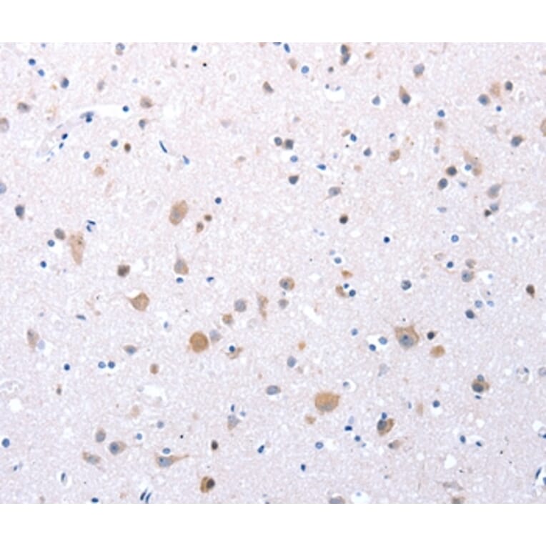 Immunohistochemistry - CCKAR Antibody from Signalway Antibody (36882) - Antibodies.com