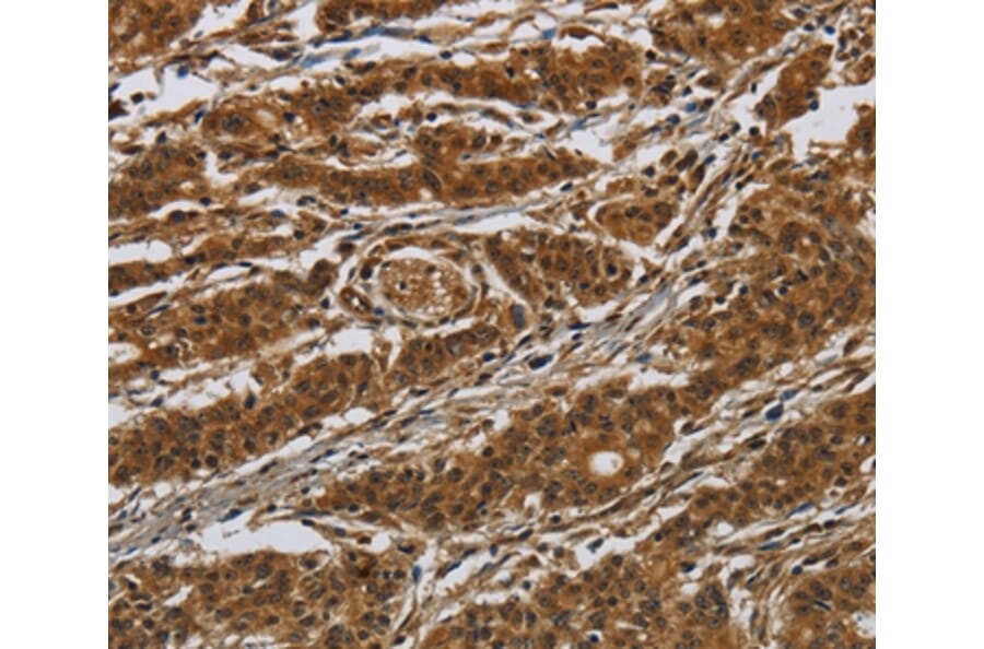 Immunohistochemistry - GATA5 Antibody from Signalway Antibody (36883) - Antibodies.com