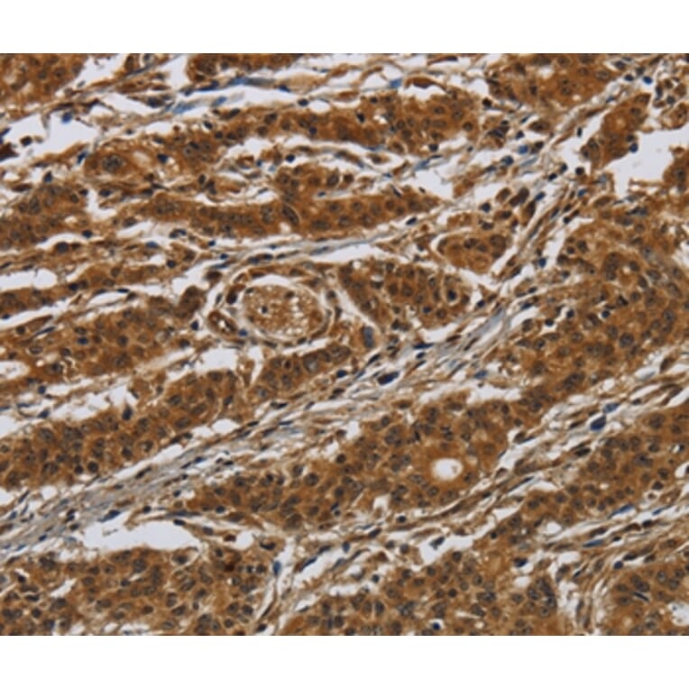 Immunohistochemistry - GATA5 Antibody from Signalway Antibody (36883) - Antibodies.com