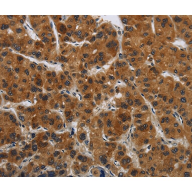 Immunohistochemistry - GATA5 Antibody from Signalway Antibody (36883) - Antibodies.com
