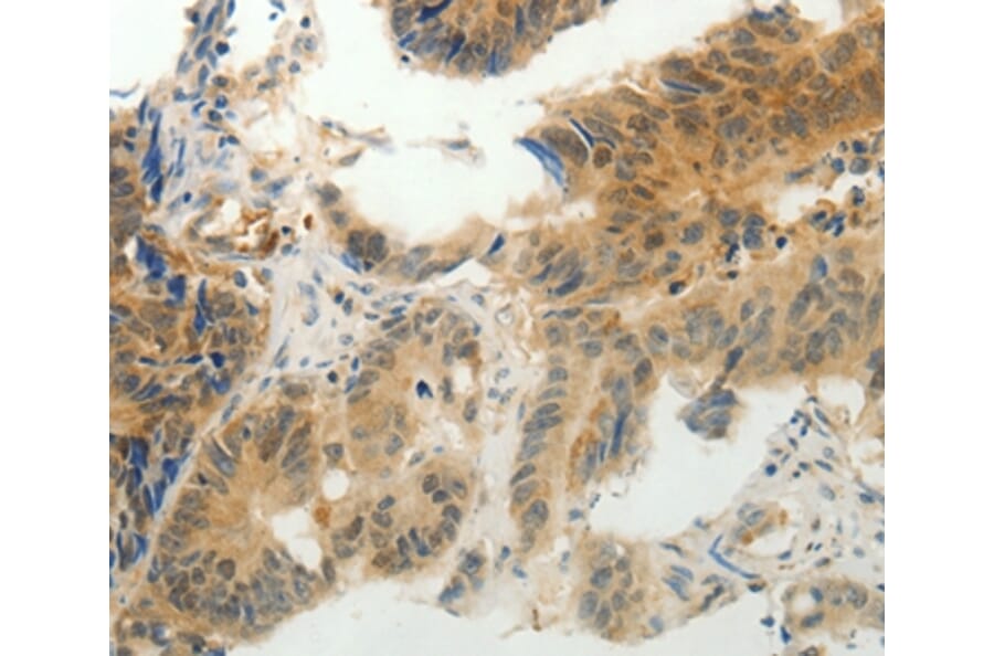 Immunohistochemistry - CMTM7 Antibody from Signalway Antibody (36884) - Antibodies.com