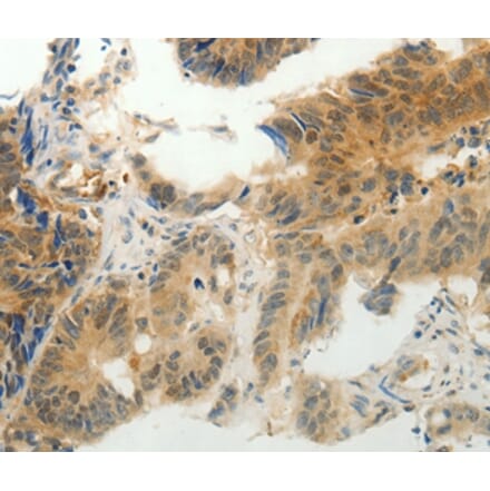 Immunohistochemistry - CMTM7 Antibody from Signalway Antibody (36884) - Antibodies.com