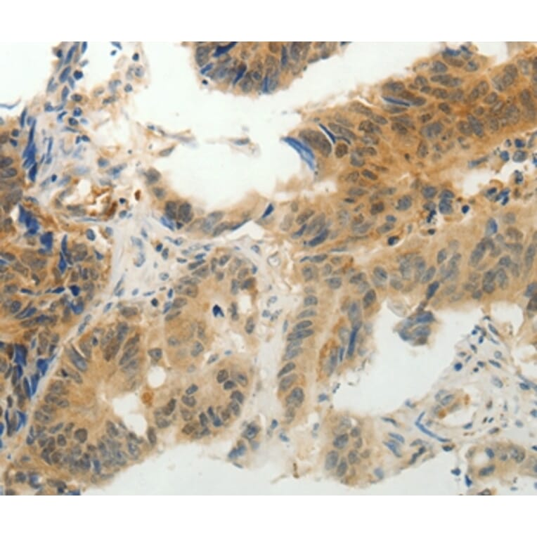 Immunohistochemistry - CMTM7 Antibody from Signalway Antibody (36884) - Antibodies.com