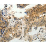 Immunohistochemistry - CMTM7 Antibody from Signalway Antibody (36884) - Antibodies.com