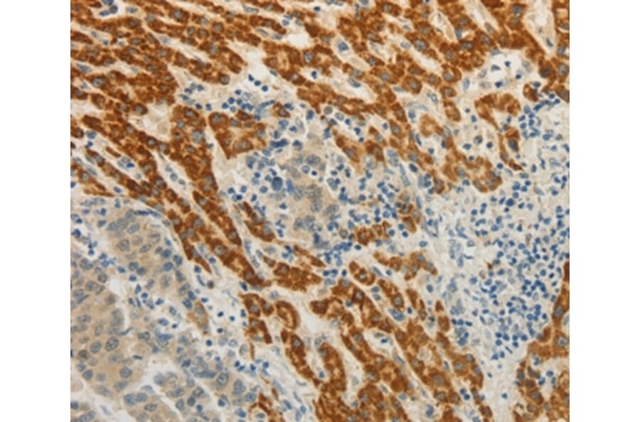 Immunohistochemistry - CMTM7 Antibody from Signalway Antibody (36884) - Antibodies.com