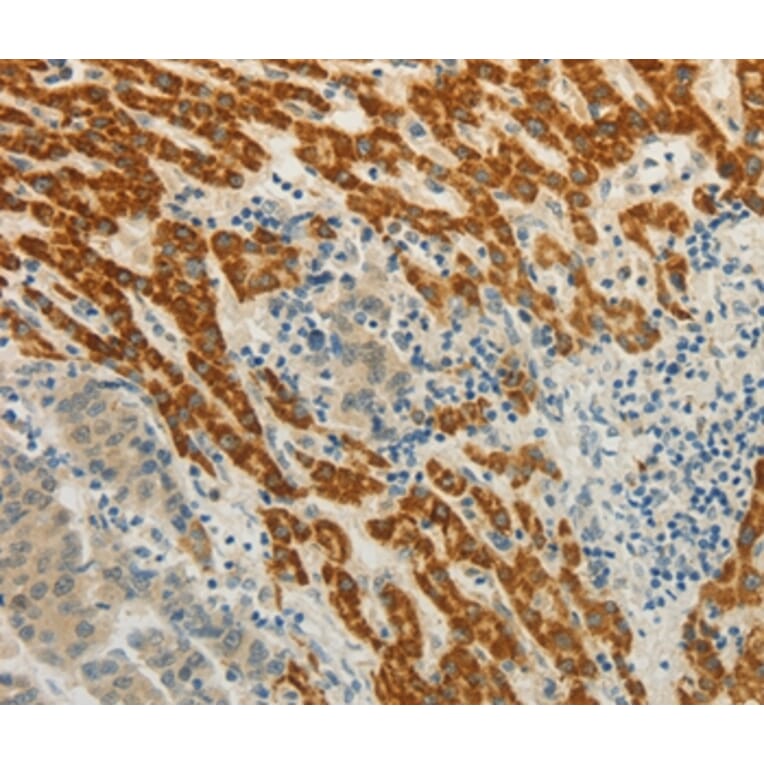 Immunohistochemistry - CMTM7 Antibody from Signalway Antibody (36884) - Antibodies.com