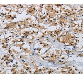 Immunohistochemistry - CMTM8 Antibody from Signalway Antibody (36887) - Antibodies.com