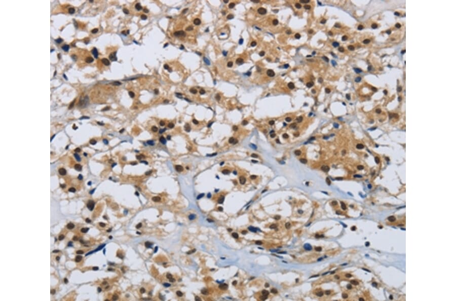 Immunohistochemistry - CMTM8 Antibody from Signalway Antibody (36887) - Antibodies.com