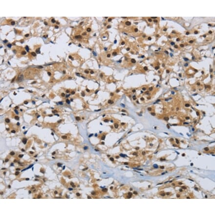 Immunohistochemistry - CMTM8 Antibody from Signalway Antibody (36887) - Antibodies.com