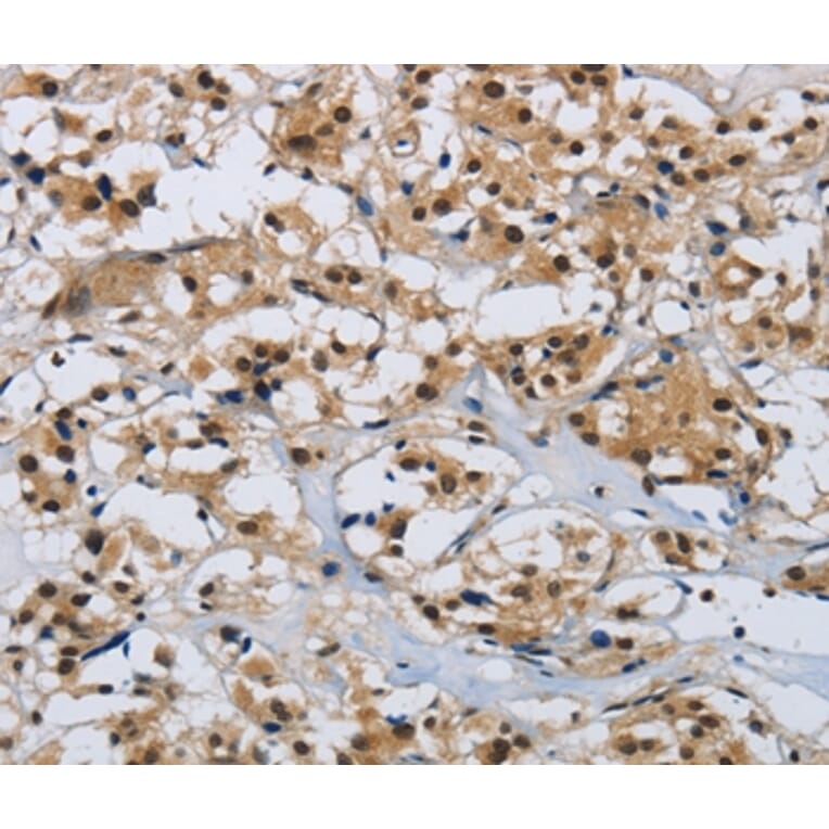 Immunohistochemistry - CMTM8 Antibody from Signalway Antibody (36887) - Antibodies.com