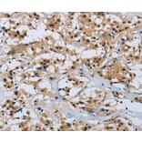 Immunohistochemistry - CMTM8 Antibody from Signalway Antibody (36887) - Antibodies.com