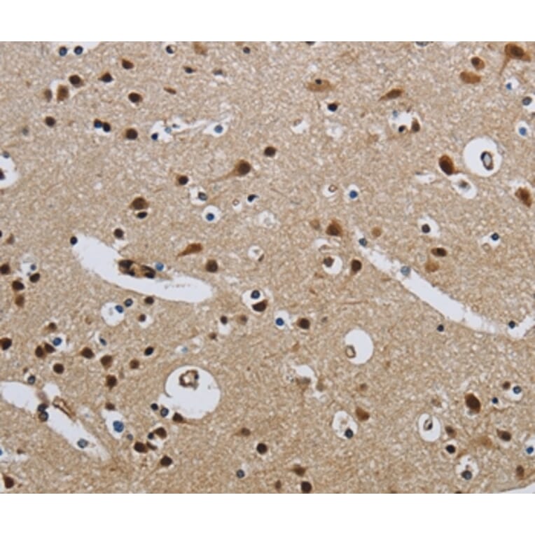 Immunohistochemistry - CMTM8 Antibody from Signalway Antibody (36887) - Antibodies.com