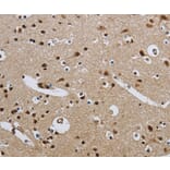 Immunohistochemistry - CMTM8 Antibody from Signalway Antibody (36887) - Antibodies.com