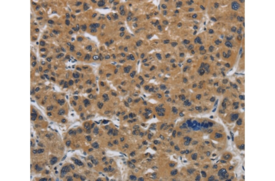 Immunohistochemistry - CLDN2 Antibody from Signalway Antibody (36890) - Antibodies.com